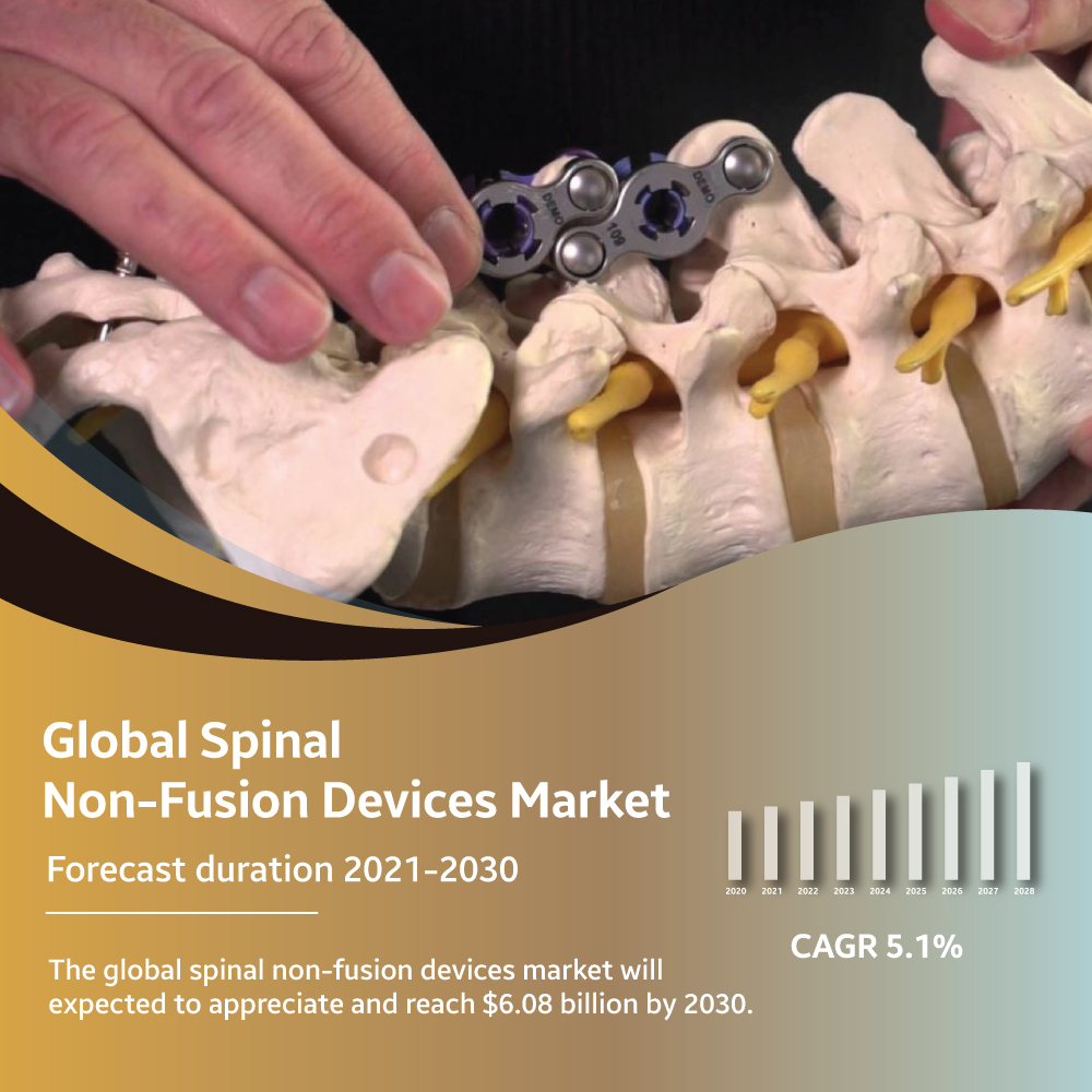 spinal non-fusion devices